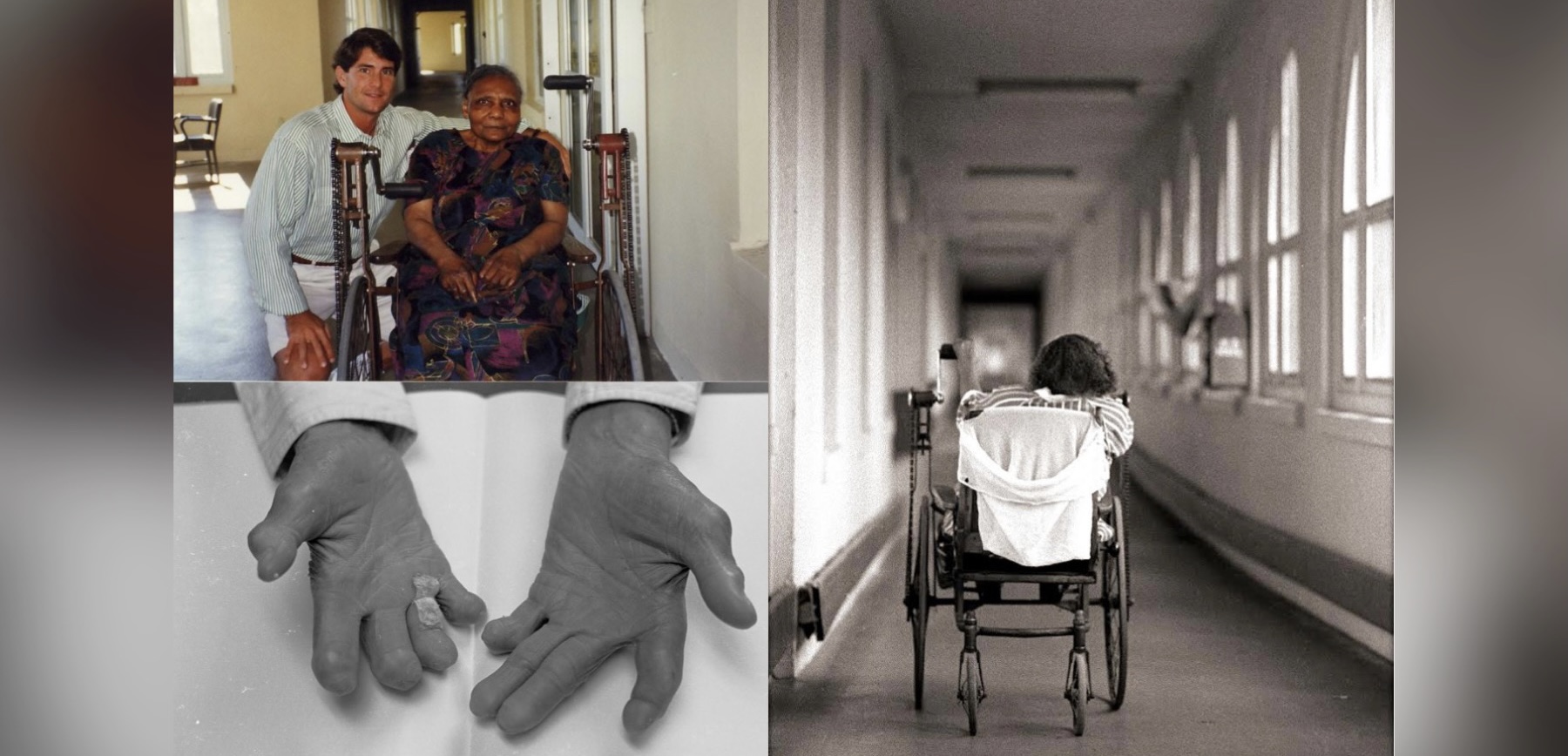 Being Imprisoned with Leprosy Patients Changed His Life